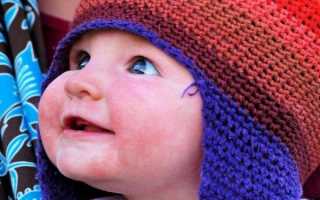 Почему у новорожденного красные щеки