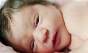 Кишечная непроходимость у новорожденных симптомы, причины, лечение (операции), отзывы