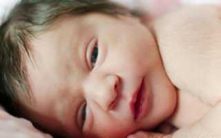 Кишечная непроходимость у новорожденных симптомы, причины, лечение (операции), отзывы