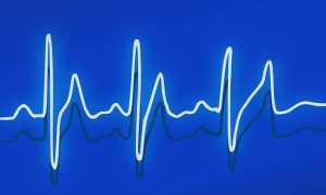 Электрофорез для грудничков