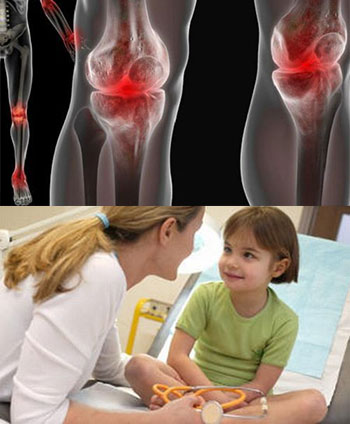 диагностика реактивного артрита у детей