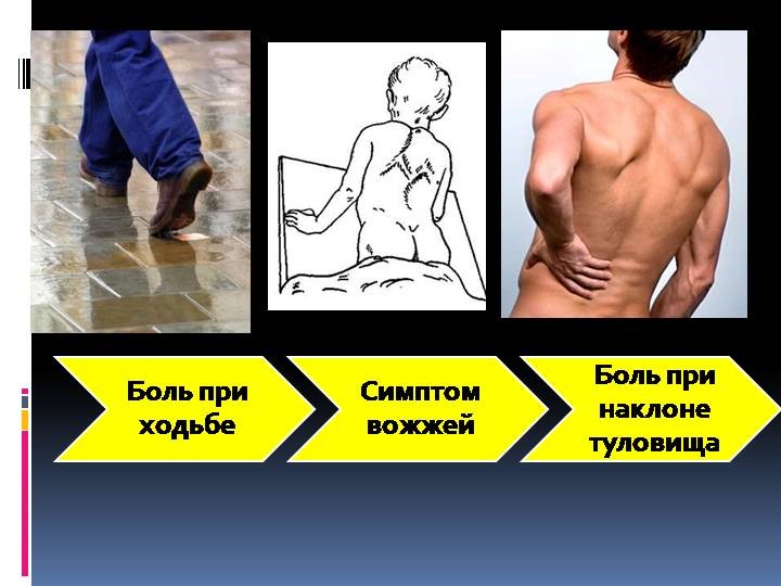 Симптомы туберкулеза костей и суставов