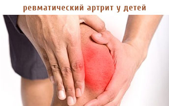 ревматический артрит у детей