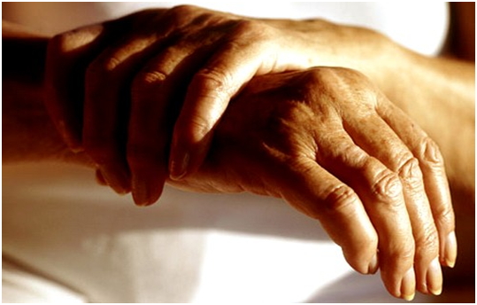 Мелкие суставы конечностей отекают при ревматоидном артрите