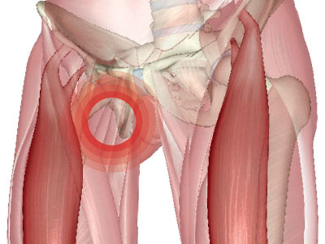 Как выглядит увеличение паховых лимфоузлов у мужчин
