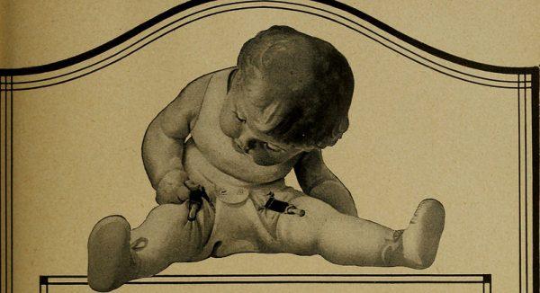 несимметричные складки на ножках у грудничка