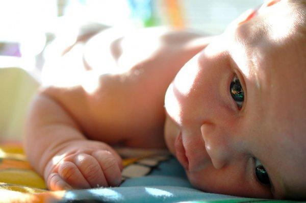 Неровная голова у грудничка