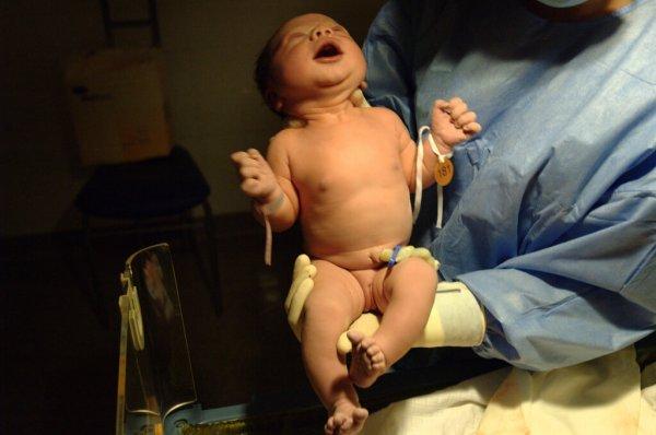 Диагностика церебральной ишемии