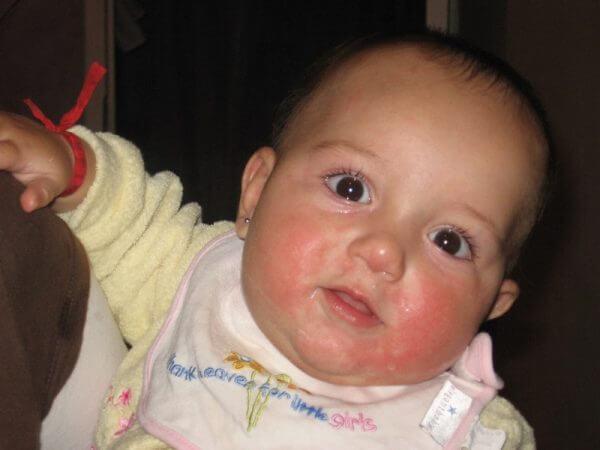 супрастин для грудничков