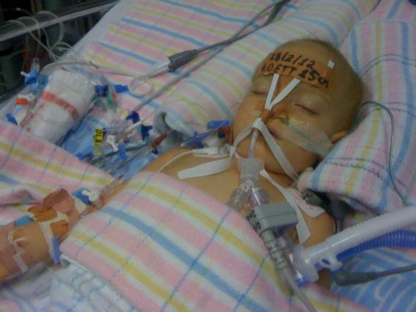 вентрикуломегалия у плода причины