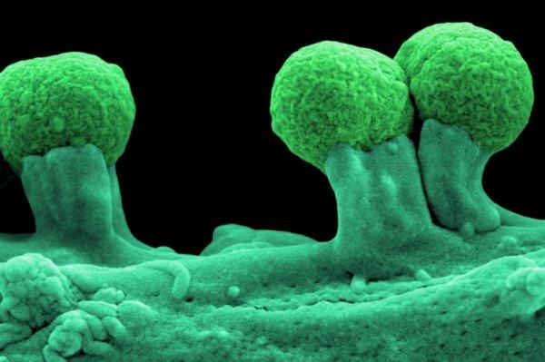 Показания для Энтеросгеля