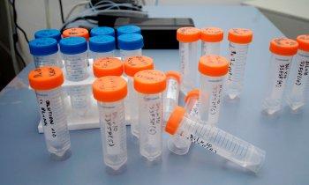 Анализы на 9 месяце