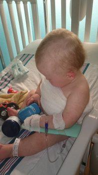 гидроцефалия головного мозга у грудничка