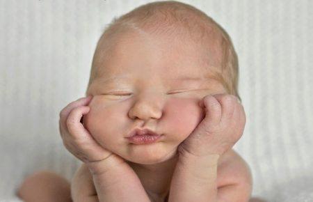 кефалогематома у новорожденных лечение