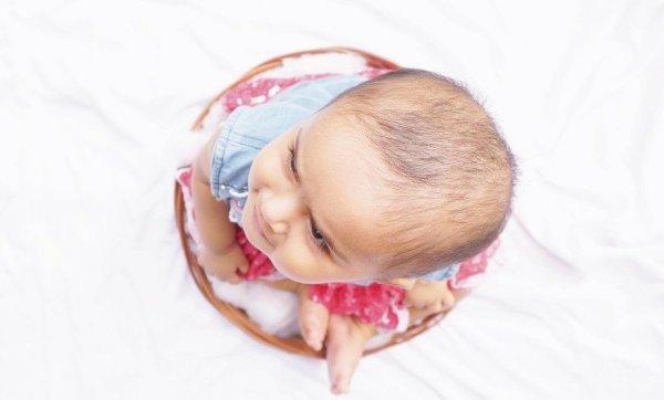 Признаки алопеции у ребенка