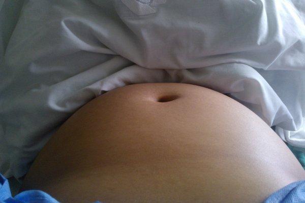 Гипертиреоз и вынашивание