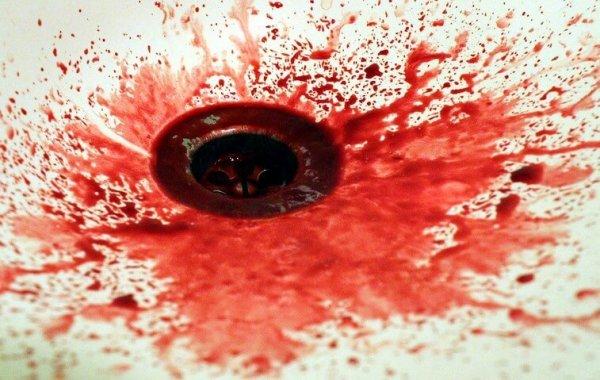 Опасность носового кровотечения