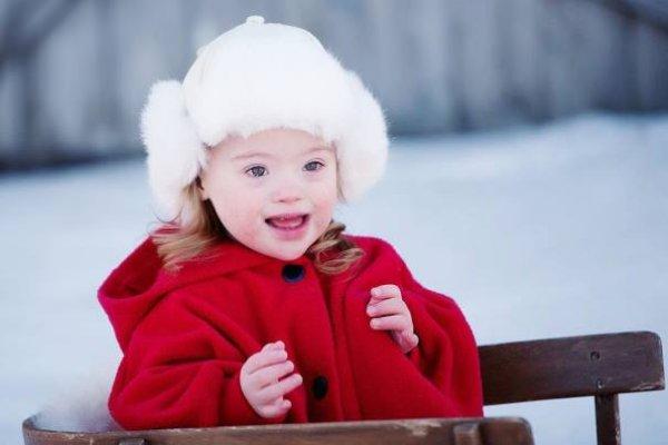 синдром дауна