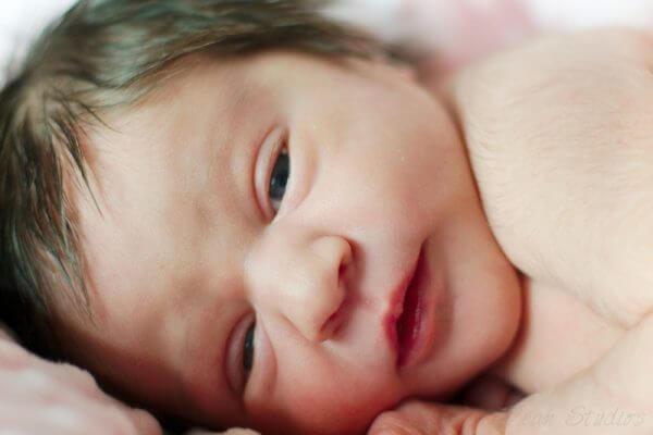 кишечная непроходимость