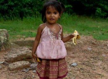 Аллергия на банан у малыша