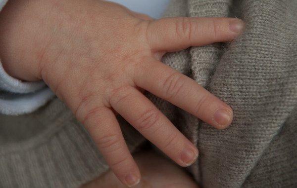 Лечение мраморности кожи