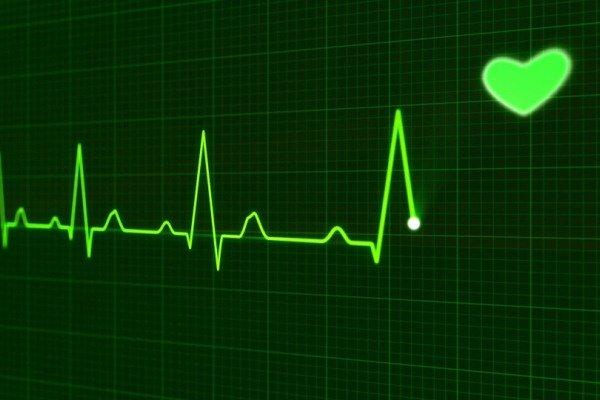 Виды тахикардии