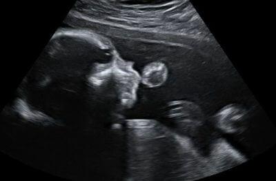 малыш в утробе