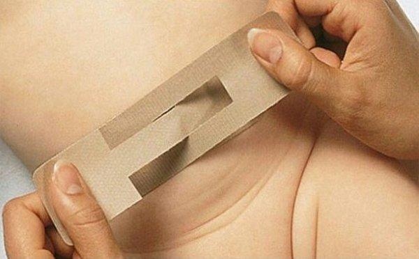 Домашнее лечение грыжи