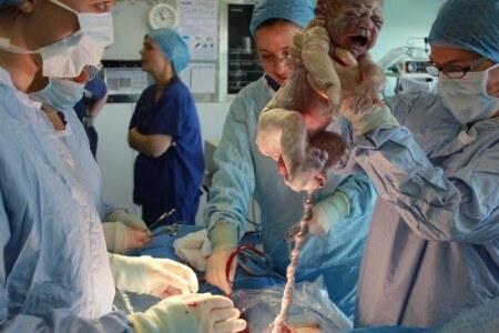 высокое давление после родов причины