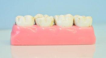 Отличие Камистада бэби