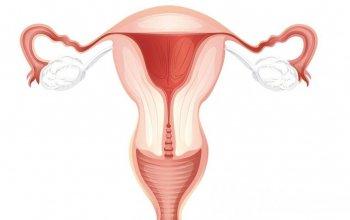 восстановление матки