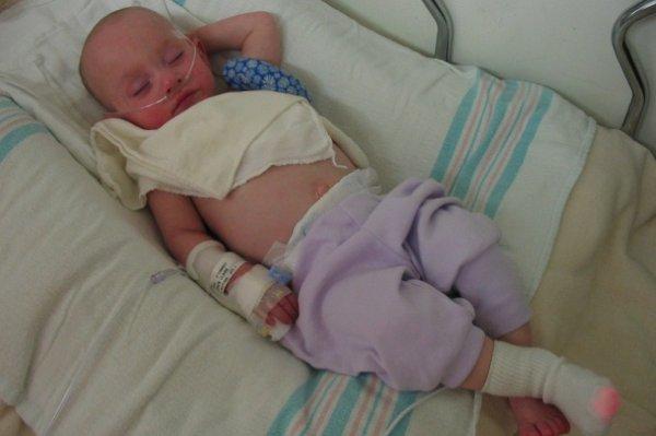 Лечение пневмонии