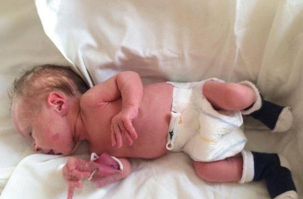 Симптомы порока сердца