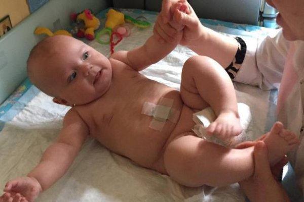 Восстановление после операции на грыжу