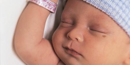 Родимое пятно у новорожденного