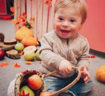 развитие ребенка с синдромом дауна