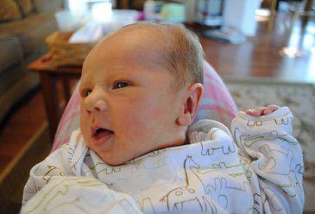 кефалогематома у новорожденных