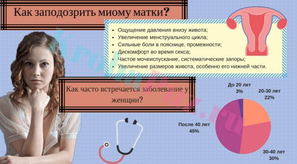 Симптомы миомы матки