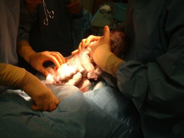 как побороть страх перед родами